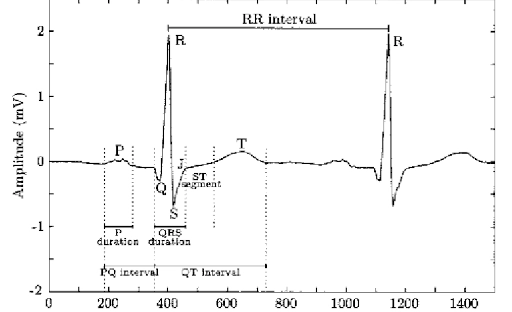 VST Project - Image 2